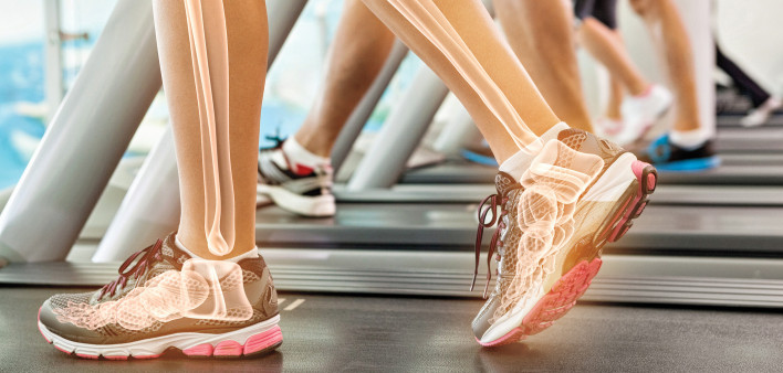woman on treadmil with illustration of her bones