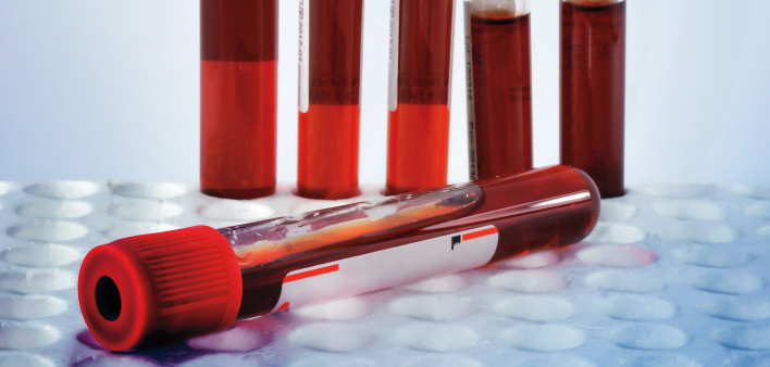 red blood in test tubes in tray