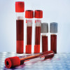 red blood in test tubes in tray