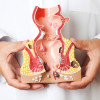 doctor holding model of rectum colon anus