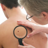 Skin cancer examination