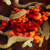Novel coronavirus SARS-CoV-2