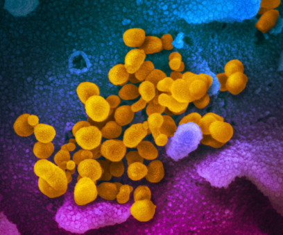 Novel coronavirus SARS-CoV-2