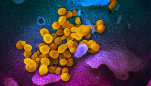 Novel coronavirus SARS-CoV-2