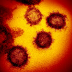 Novel coronavirus SARS-CoV-2