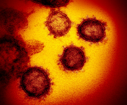 Novel coronavirus SARS-CoV-2