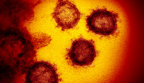 Novel coronavirus SARS-CoV-2