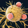 T cells (pink) attacking a cancer cell