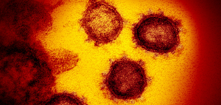 Novel coronavirus SARS-CoV-2