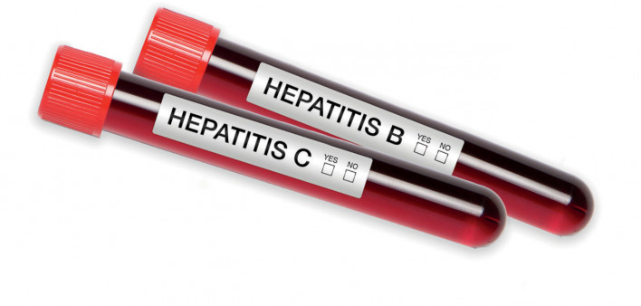 Hepatitis C Hepatitis B blood test tubes