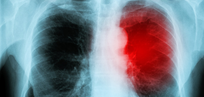 red heart of a human X-ray image from a human body part, for medical disease diagnosis.