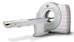 CT scan, CT scanner, LDCT