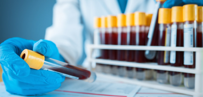 Laboratory result with blood tubes