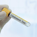 test tube with Cholesterol Test written