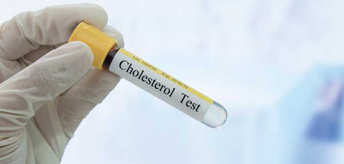 test tube with Cholesterol Test written