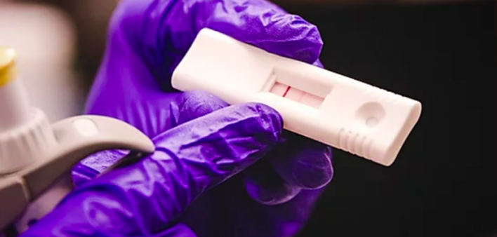 A UrSure tests measure adherence to PrEP