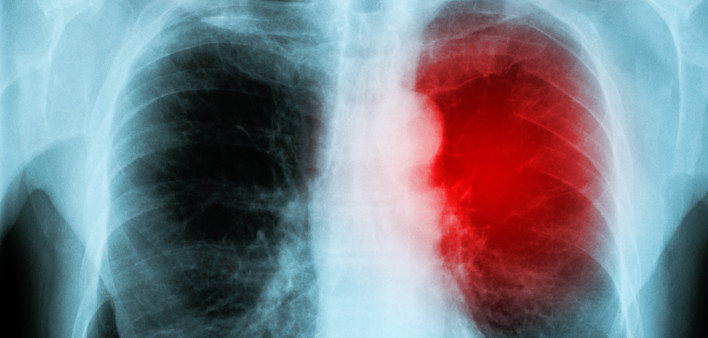 red heart of a human X-ray image from a human body part, for medical disease diagnosis.