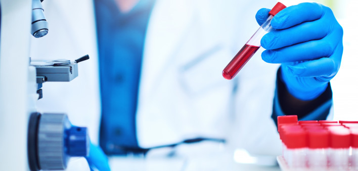 Closeup shot of a scientist analyzing samples in a laboratory