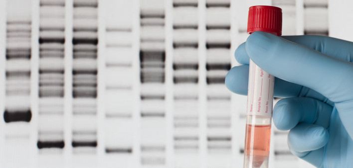 A hand with a blue medical gloves is holding a medical sample in front of a computer screen with the results of a DNA test.