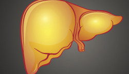 fatty liver