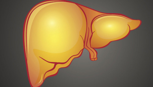 fatty liver