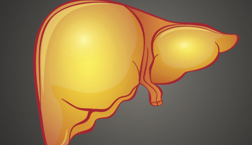 fatty liver