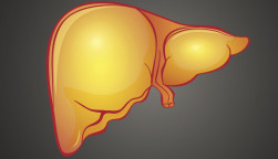 fatty liver