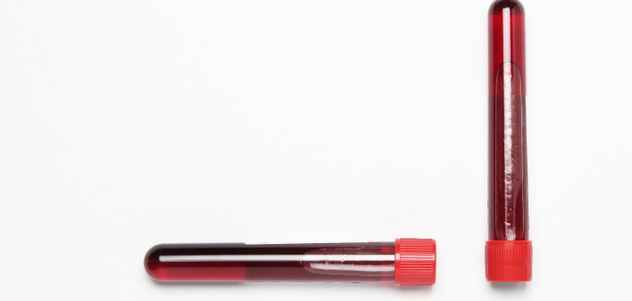 test tubes with red blood