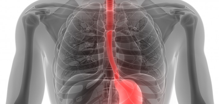 esophagus, throat, stomach, gastric, digestive tract