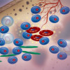 Multiple myeloma cells