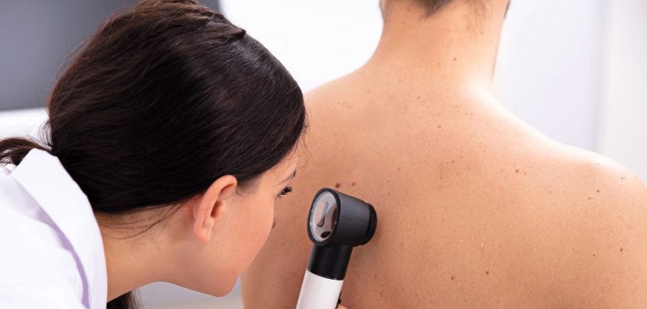 doctor looking for skin cancer melanoma