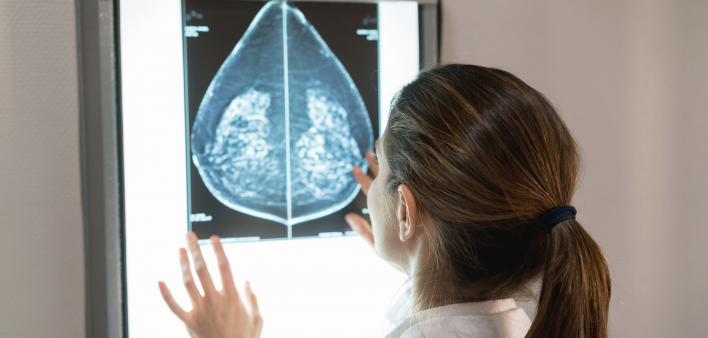 doctor looks at x ray of breast mamagram