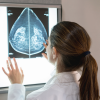 doctor looks at x ray of breast mamagram