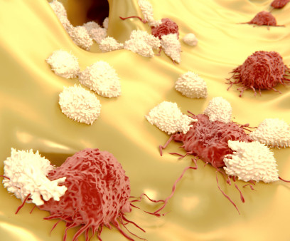 Lymphocytes attacking cancer cells 