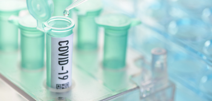 vial with pipette in laboratory